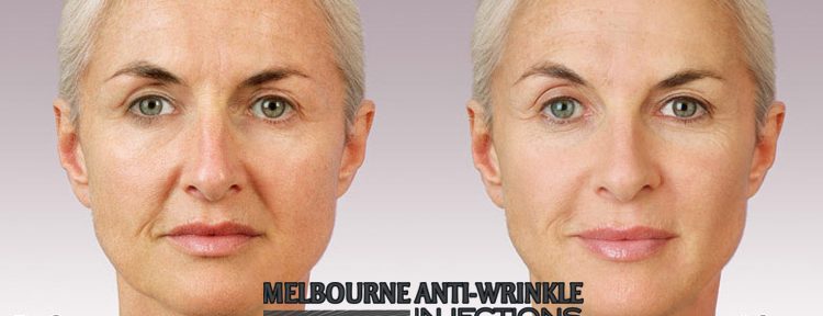 Anti-Wrinkle Injections Melbourne-Melbourne Anti-Wrinkle Injecti Dermal Fillers and Botox anti-wrinkle treatment at Melbourne anti-wrinkle clinic