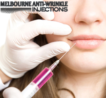 Dermal Fillers for Lips