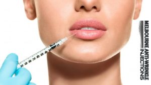 lip-injections